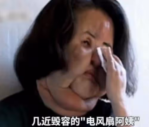 女歌手整容成癮致毀容,生前照片令人唏噓,家人:她從前那麼美