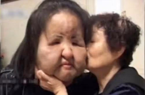 女歌手整容成癮致毀容,生前照片令人唏噓,家人:她從前那麼美
