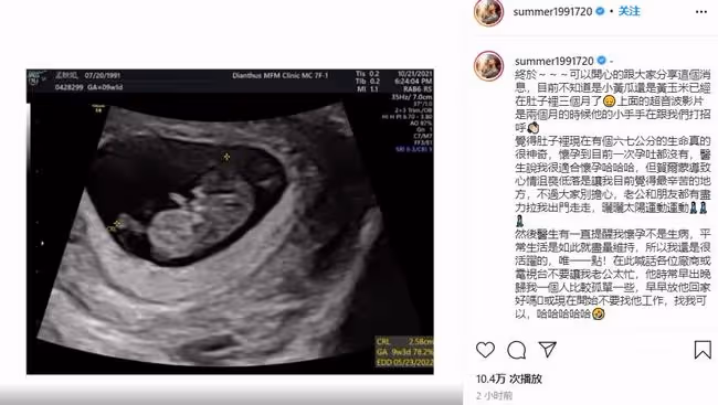 恭喜！49歲黃子佼宣布當爸，小19歲嬌妻懷孕3個月，開心曬B超照
