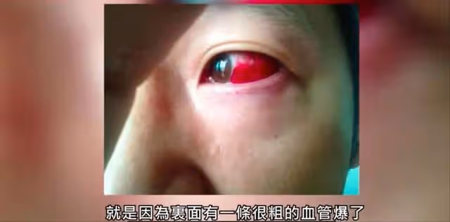 祝福!前TVB知名男星老婆胸椎生腫瘤致行動不便,手術成功報平安