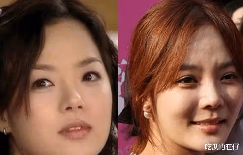 蔡琳:韓國早期的人工美女之一,現如今婚姻破碎、顏值下降