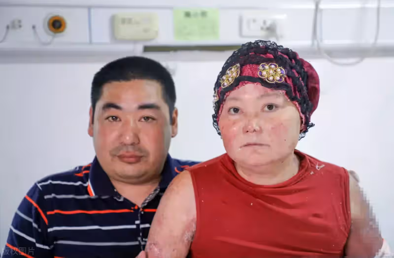 相濡以沫!身障丈夫24小時照顧患病妻 為省錢「兩塊饅頭吃3天」心酸又暖心:妻子是第一位