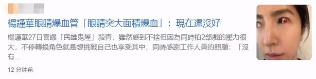 44歲知名女星楊謹華眼睛血管破裂,2周未痊癒!嫁富商3年仍沒生娃