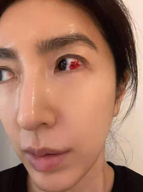 44歲知名女星楊謹華眼睛血管破裂,2周未痊癒!嫁富商3年仍沒生娃