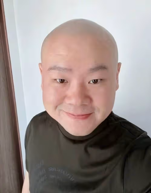 岳雲鵬患脂肪瘤後暴瘦!瘦出尖下巴肚腩消失,疑無緣虎年央視春晚