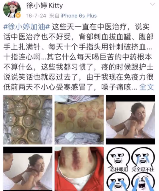 6年前,女演員徐婷全身潰爛在醫院離世,背後原因讓人唏噓