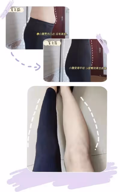 張雨綺縱慾行為被扒？奶狗舊照流出，瘦身後卷土歸來？