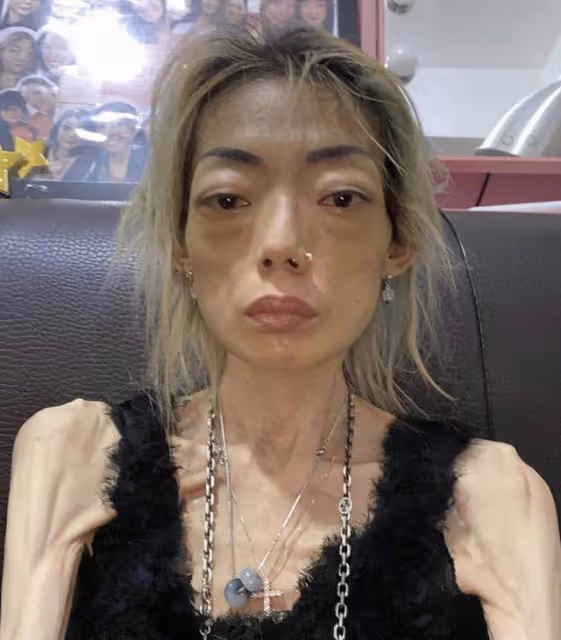 香港名模近況曝光!厭食症開始有所好轉,太子爺前夫已經再婚