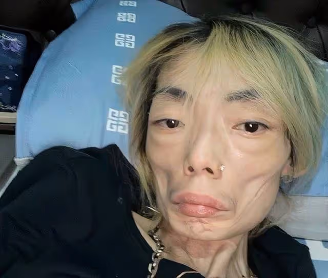 香港名模近況曝光!厭食症開始有所好轉,太子爺前夫已經再婚