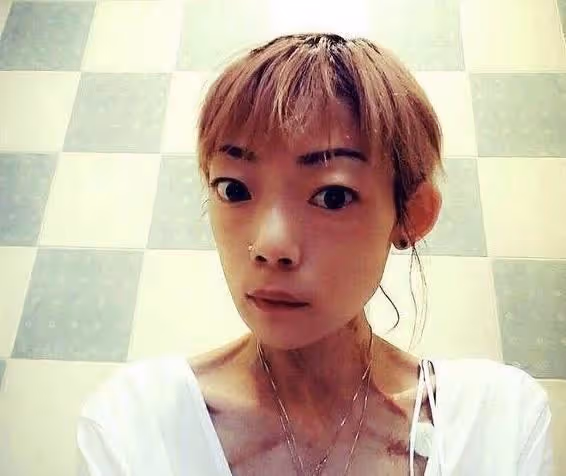香港名模近況曝光!厭食症開始有所好轉,太子爺前夫已經再婚