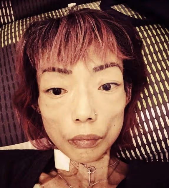 香港名模近況曝光!厭食症開始有所好轉,太子爺前夫已經再婚