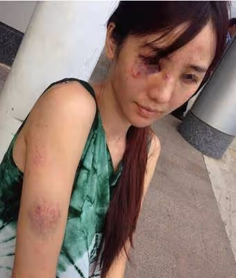 23歲的她因孫儷一夜走紅,結婚之後並不幸福,最終因為癌症離世