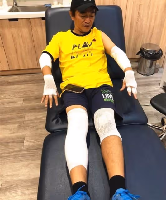 知名主持胡瓜被鞭炮炸傷小腿，褲子炸破一個洞，一旁女星受到驚嚇
