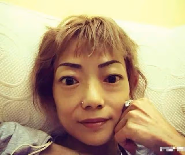 伍智恆病情突然好轉,臉部圓潤不再嚇人,放下渣男終於戰勝了病魔