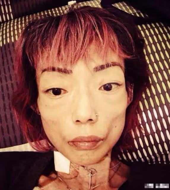 伍智恆病情突然好轉,臉部圓潤不再嚇人,放下渣男終於戰勝了病魔
