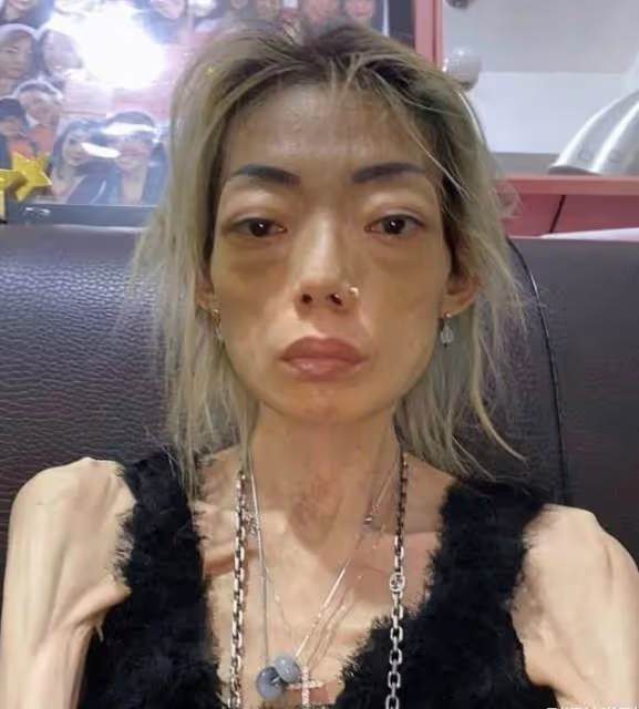 伍智恆病情突然好轉,臉部圓潤不再嚇人,放下渣男終於戰勝了病魔