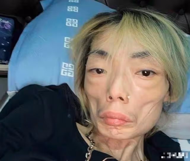 伍智恆病情突然好轉,臉部圓潤不再嚇人,放下渣男終於戰勝了病魔