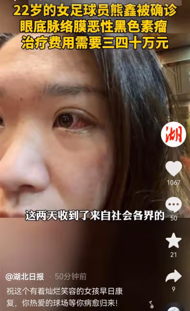 22歲女足球員患癌後求助,3小時獲捐50萬,將接受放療盼重回球場