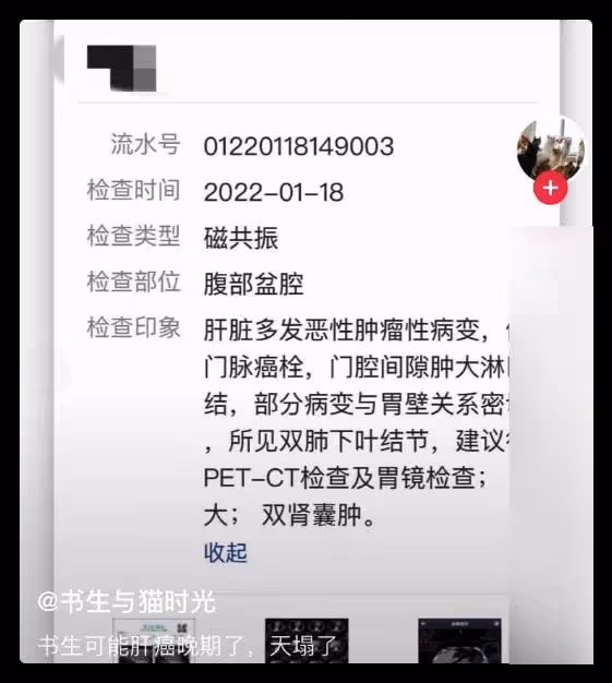 知名網紅因肝癌晚期去世,將無償捐獻遺體,上個月還在眾籌醫藥費
