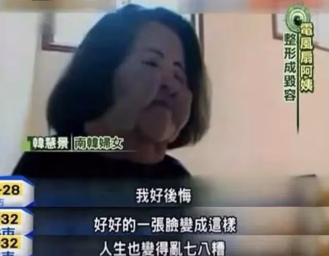 「整容上癮」韓慧景:把臉整成電風扇,自行注射食用油,代價慘痛