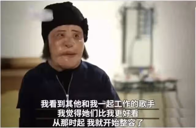 「整容上癮」韓慧景:把臉整成電風扇,自行注射食用油,代價慘痛