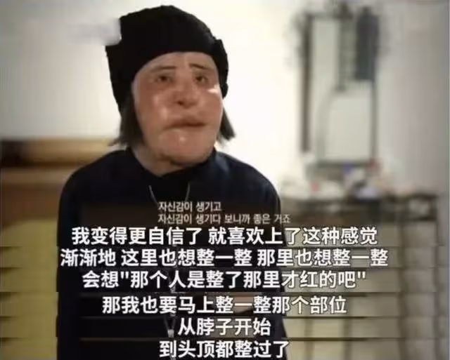 「整容上癮」韓慧景:把臉整成電風扇,自行注射食用油,代價慘痛
