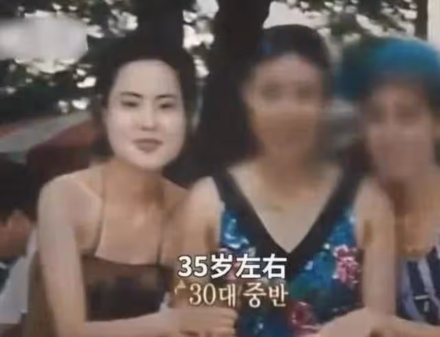 「整容上癮」韓慧景:把臉整成電風扇,自行注射食用油,代價慘痛