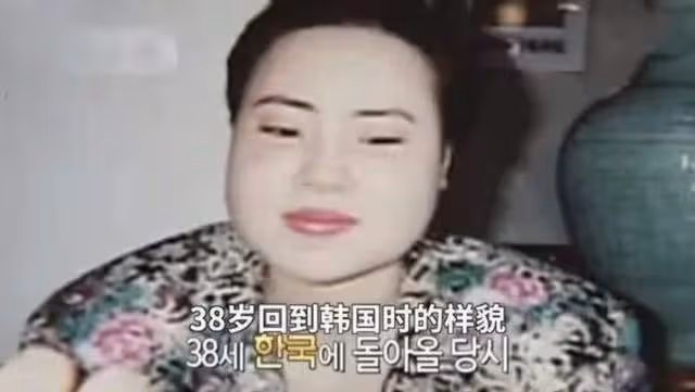「整容上癮」韓慧景:把臉整成電風扇,自行注射食用油,代價慘痛