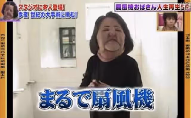 「整容上癮」韓慧景:把臉整成電風扇,自行注射食用油,代價慘痛