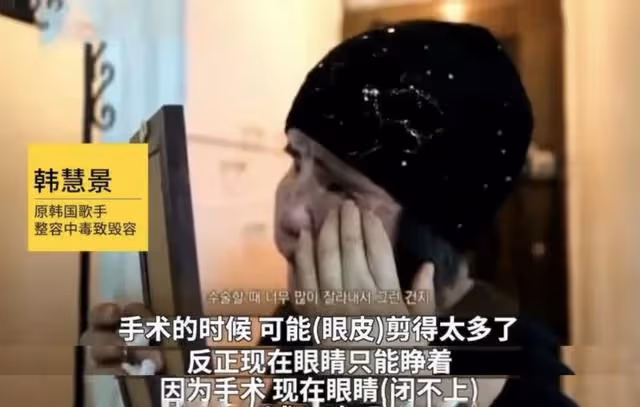 「整容上癮」韓慧景:把臉整成電風扇,自行注射食用油,代價慘痛