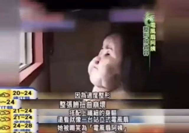 「整容上癮」韓慧景:把臉整成電風扇,自行注射食用油,代價慘痛