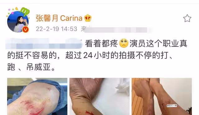 林峯拍戲意外受傷！胳膊多處傷口紅腫嚴重，表麵皮膚受損露出血肉