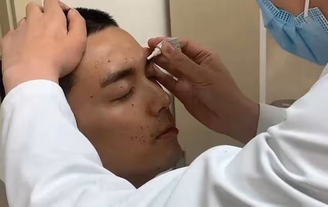 林峯拍戲意外受傷!胳膊多處傷口紅腫嚴重,表麵皮膚受損露出血肉