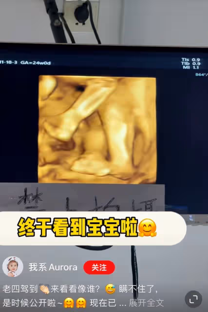 25歲網紅拼四胎惹爭議，3個女兒從小當童模養家，網友喊話求封禁