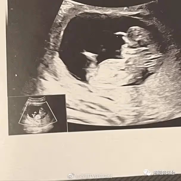 TVB最美華姐再惹離婚揣測!張致恆婚姻疑再亮紅燈