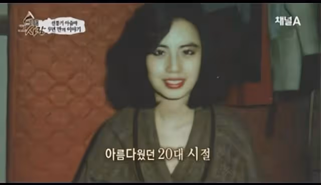 她整容上癮,為變美給臉打食用油,把臉整成電風扇,57歲去世