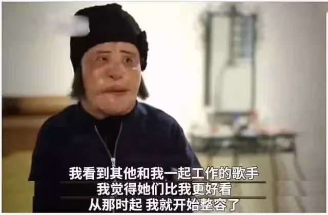她整容上癮,為變美給臉打食用油,把臉整成電風扇,57歲去世