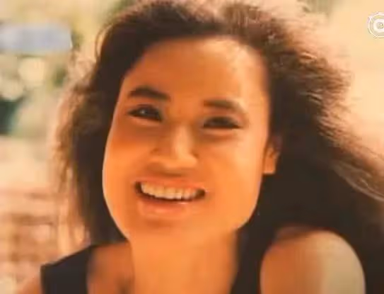 她整容上癮，為變美給臉打食用油，把臉整成電風扇，57歲去世