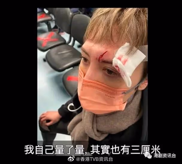 張振朗領軍36米高空游繩而下 何慈茵搞到頭破血流