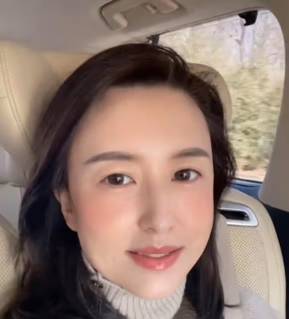 央視張蕾開6位數豪車出鏡,面色紅潤疑醉酒,下巴變尖被質疑整容