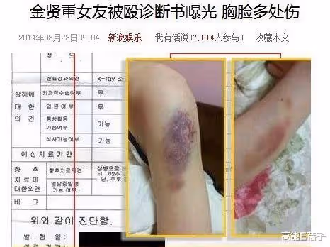 35歲金賢重宣布結婚,曾因前女友誣陷家暴致流產事業盡毀