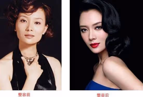 陳數早年與現在的臉變化實在是太大了,簡直就是整容最成功的女星,沒有之一!