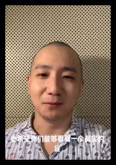 38歲演員得白血病後曝近況！確診抑鬱症入睡困難，莫名其妙想發火