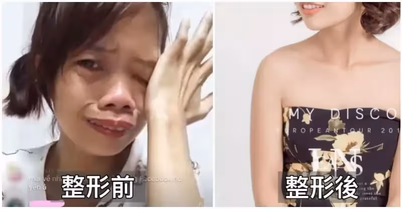 單親媽直播賺錢被笑「妳長得好像河童！」節目出錢讓她整形「變身韓系電眼女神」正到逆齡20歲