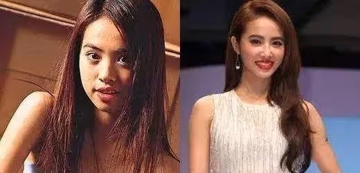 表面「貌若天仙」,實則「歪瓜裂棗」的六位女星,個個整得太成功