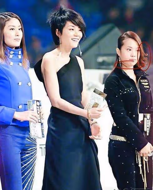 表面「貌若天仙」,實則「歪瓜裂棗」的六位女星,個個整得太成功