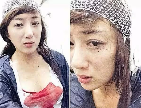 表面「貌若天仙」,實則「歪瓜裂棗」的六位女星,個個整得太成功