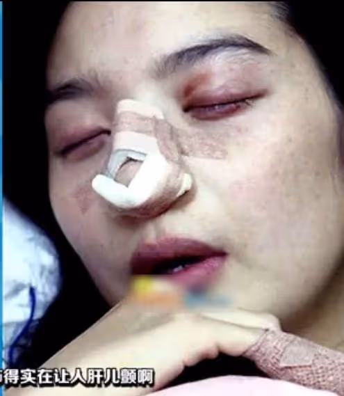 嫁男星13天後，丈夫原形畢露，李敏英自曝被家暴，數次想要逃跑