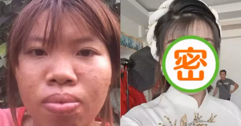 太難看被休妻！她砸錢整容「再嫁高富帥」收穫幸福婚姻，懷孕半年「卻原形畢露」被離婚， 如今｢投資｣回本還找到第二春