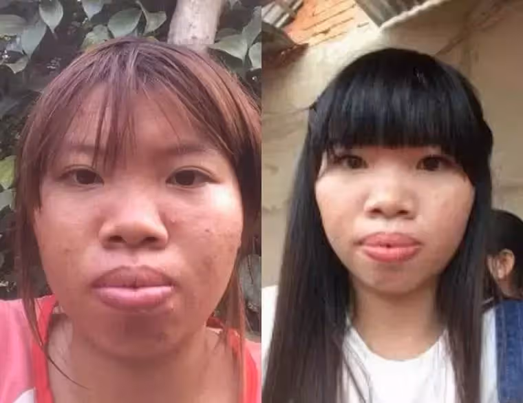 太難看被休妻!她砸錢整容「再嫁高富帥」收穫幸福婚姻,懷孕半年「卻原形畢露」被離婚, 如今「投資」回本還找到第二春